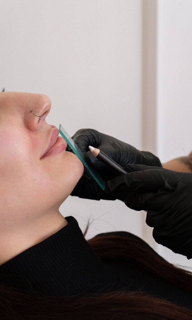 facial balancing markings at the symm label in Calgary