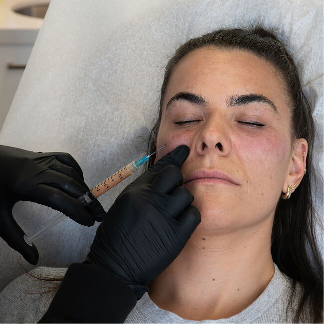Woman receiving platelet rich fibrin PRF treatment at the symm label in Calgary