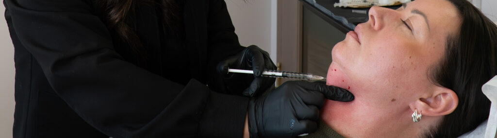 Woman receiving Belkyra fat dissolving injection under chin at the symm label in Calgary