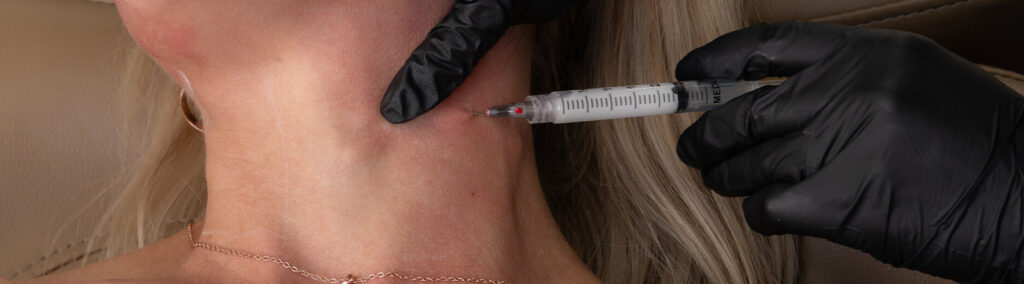 Close-up of woman receiving radiesse injection at the symm label in Calgary