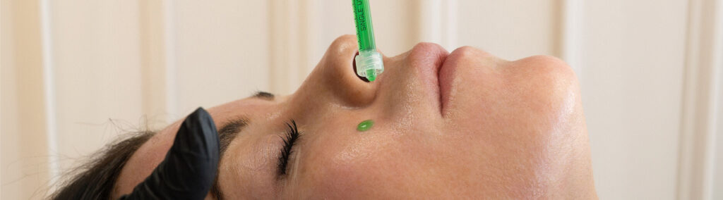 Close-up of woman receiving ultra smooth pore mesotox treatment at the symm label in Calgary