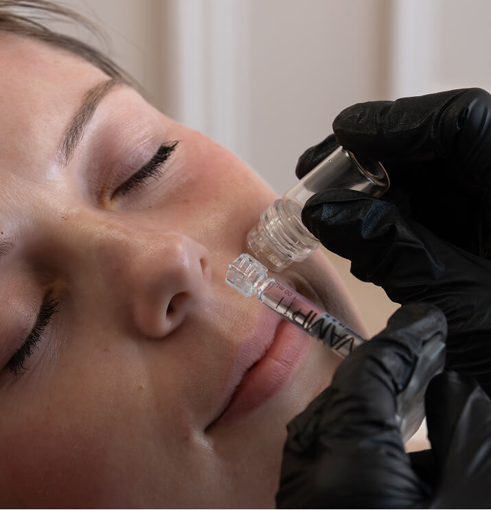 Close-up of woman receiving VAMP PDRN skin rejuvenation treatment on cheek at the symm label in Calgary