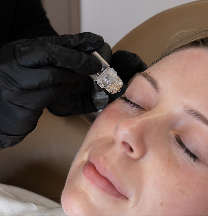 Close-up of woman receiving VAMP treatment at the symm label in Calgary