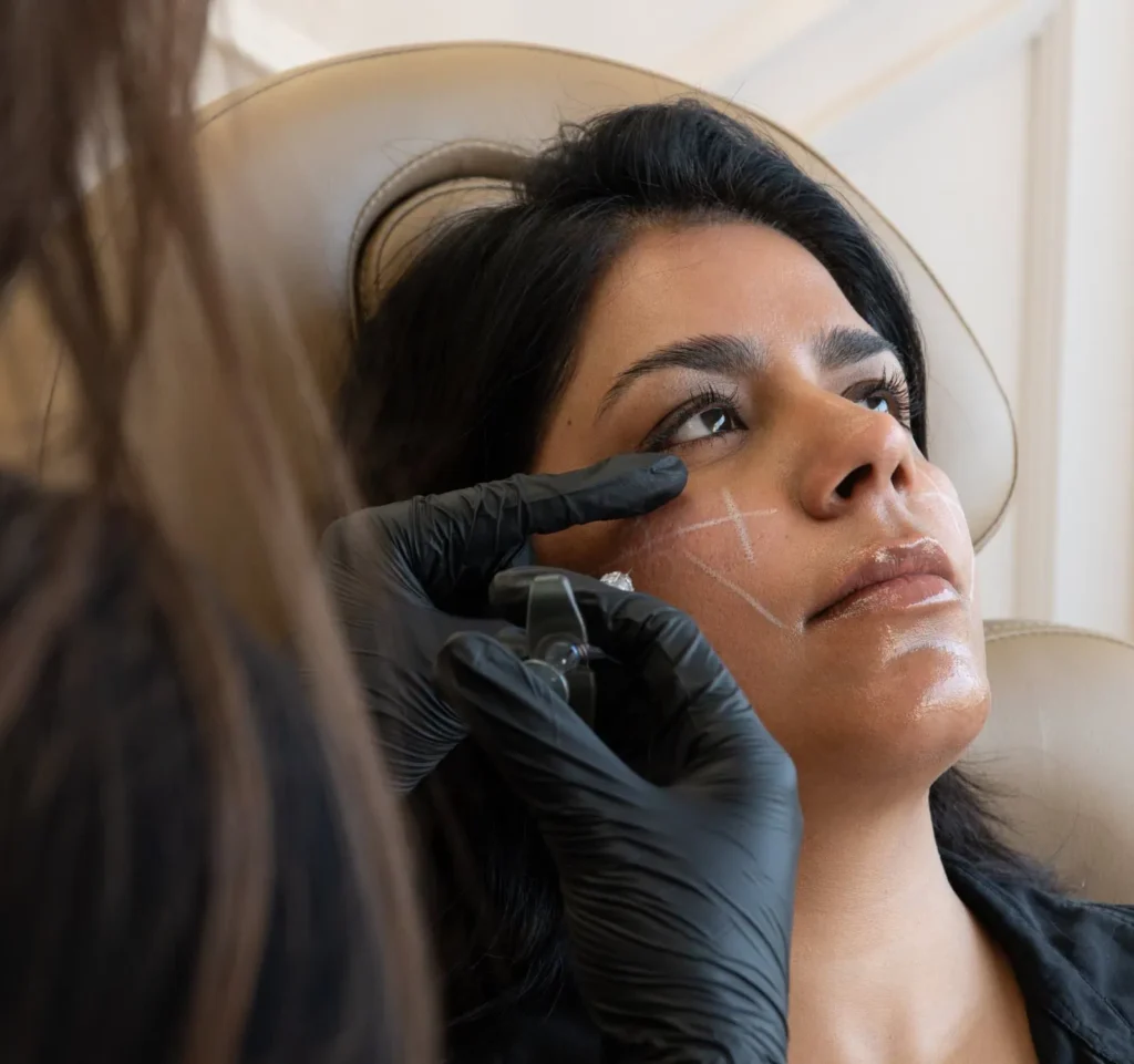 Close-up of woman receiving cheek filler at the symm label in Calgary